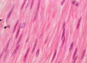 Mystery Muscle Tissue