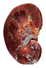 Image of Kidney